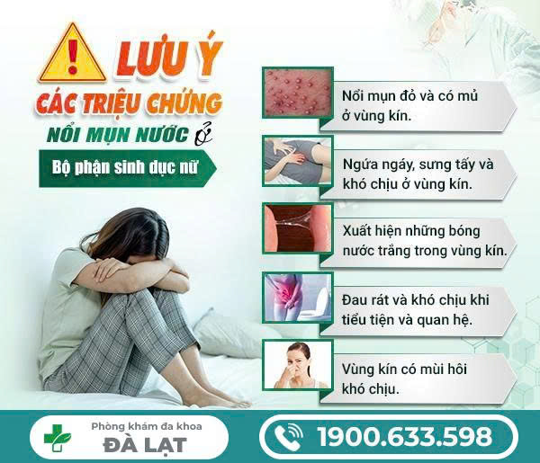 Hình ảnh minh họa